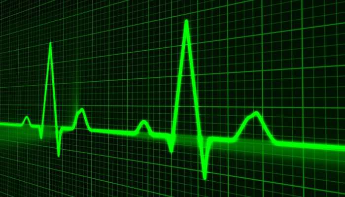 New technology can predict fatal heart attack: Study