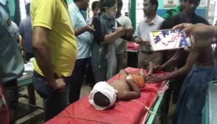 West Bengal: 3-year-old receives bullet injuries on head during clashes in Malda