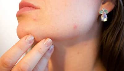 New therapy may help treat skin cancer: Scientists