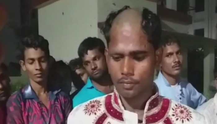 Lucknow: Groom&#039;s head tonsured after allegedly demanding bike, gold chain in dowry