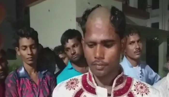 Lucknow: Groom's head tonsured after allegedly demanding bike, gold chain in dowry