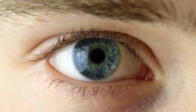 Researchers uncover genetic causes of eye disease