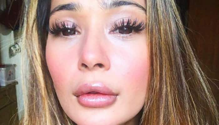 Here&#039;s the truth behind Sara Khan&#039;s lip surgery