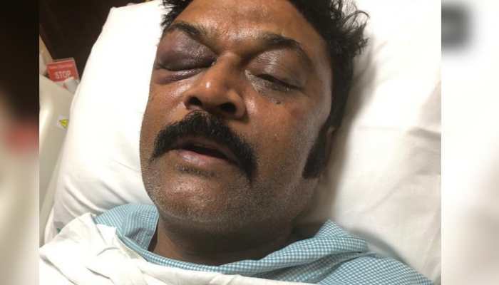 Karnataka brawl row: Congress MLA files FIR against party MLA Ganesh for assaulting him