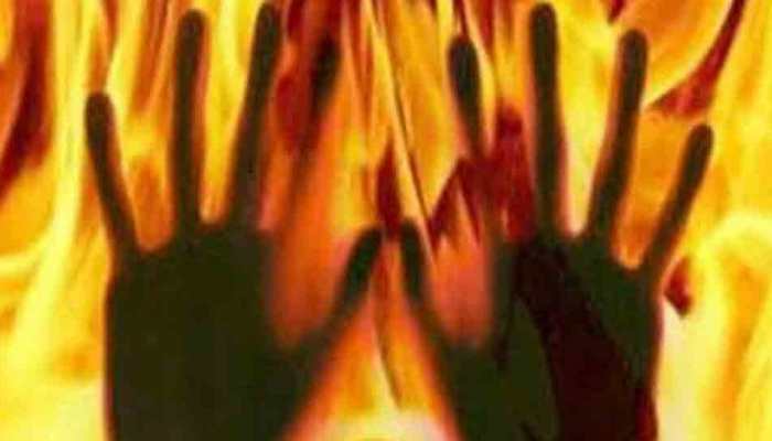 Telangana: Woman set on fire for rejecting man&#039;s proposal