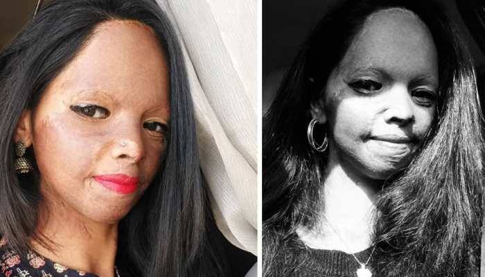 People finding beauty in an acid-burnt face: Laxmi Agarwal