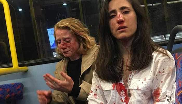 Two women beaten, robbed by gang of men in UK &#039;for refusing to kiss&#039;
