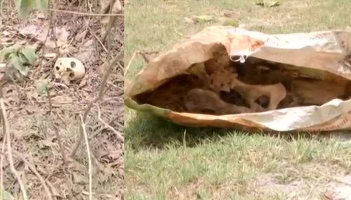 Amid rising AES deaths in Bihar, human skeletons found near Muzaffarpur's SKMCH hospital