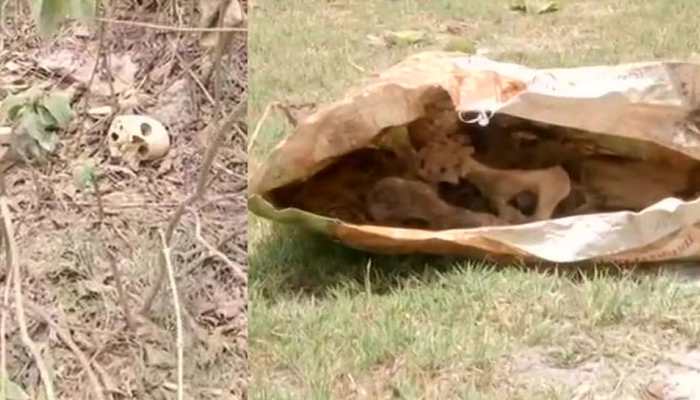 Amid rising AES deaths in Bihar, human skeletons found near Muzaffarpur's SKMCH hospital