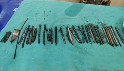 Blade, wire and pen among 33 sharp objects taken out of man’s stomach during surgery
