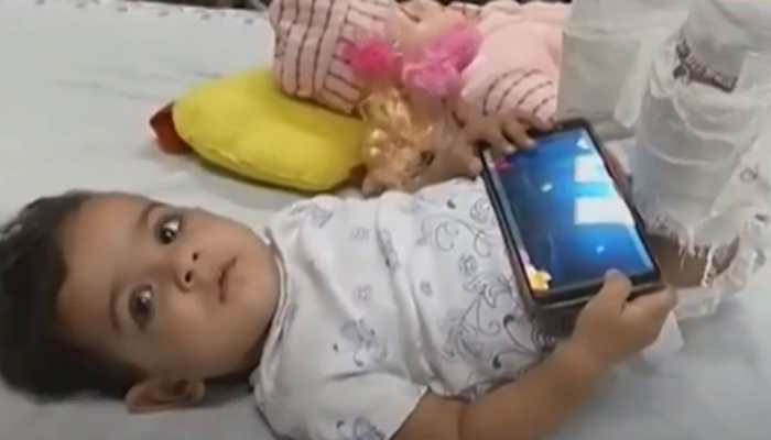 Toddler refuses to get treated for fractured legs, doctors then plaster her doll to convince her