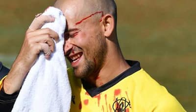 Ashton Agar left bloodied after dropping brother Wes' catch during Marsh Cup