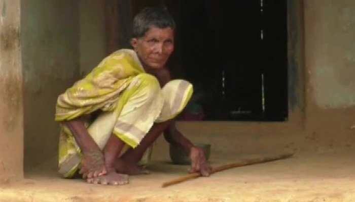 Odisha: Woman born with 20 toes, 12 fingers, branded a witch, forced to stay indoors