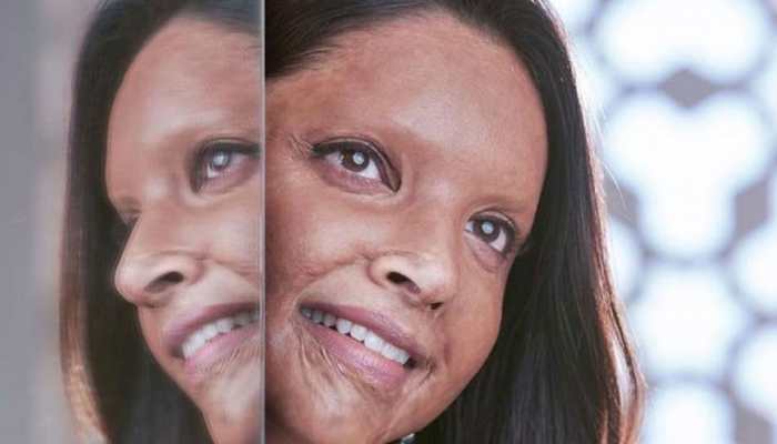 Deepika Padukone shares gripping teaser of Chhapaak- Watch video