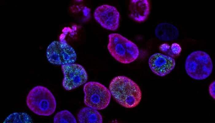 Scientists seek foot, mouth disease virus to fight pancreatic cancer