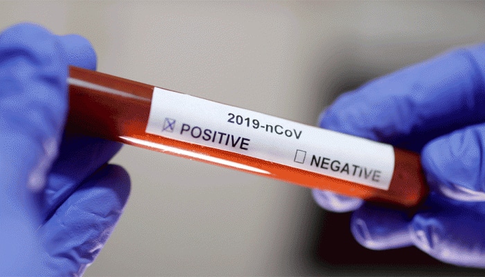 South Korea worst hit nation by coronavirus after China, confirmed cases reach 156