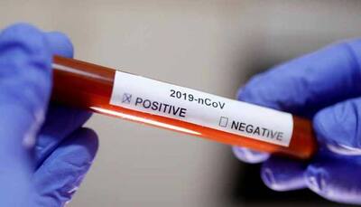Italian man tests positive for coronavirus in Rajasthan's Jaipur
