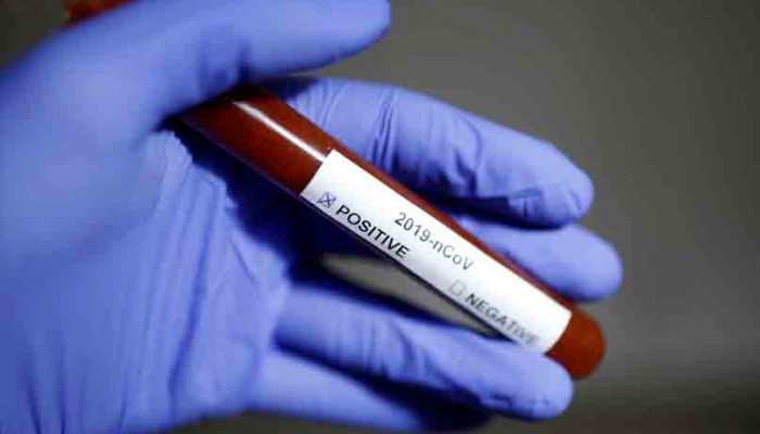 Coronavirus outbreak: 3-year-old tests positive in Kerala, India cases jump to 40