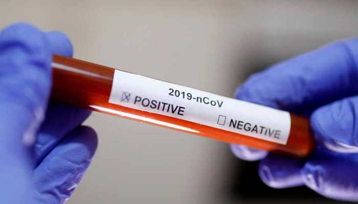 One suspected Coronavirus death in Karnataka; samples taken for test says Health Commissioner