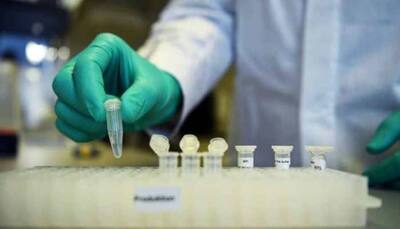 Centre, ICMR issue guidelines for private labs to test coronavirus