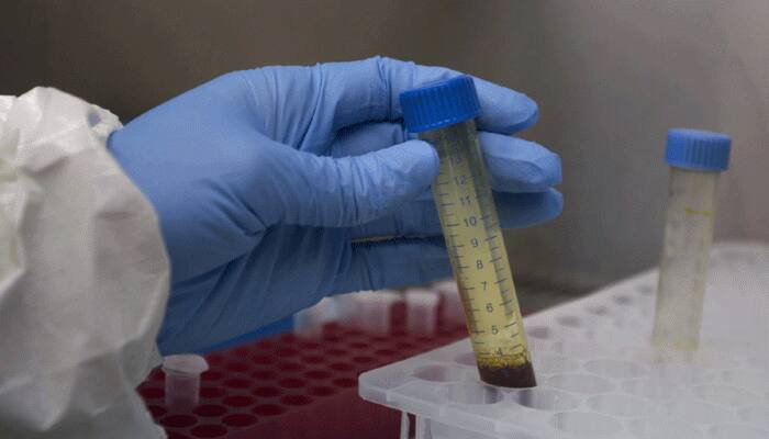 ICMR approves 121 government labs for coronavirus COVID-19 test as India death toll reaches 18