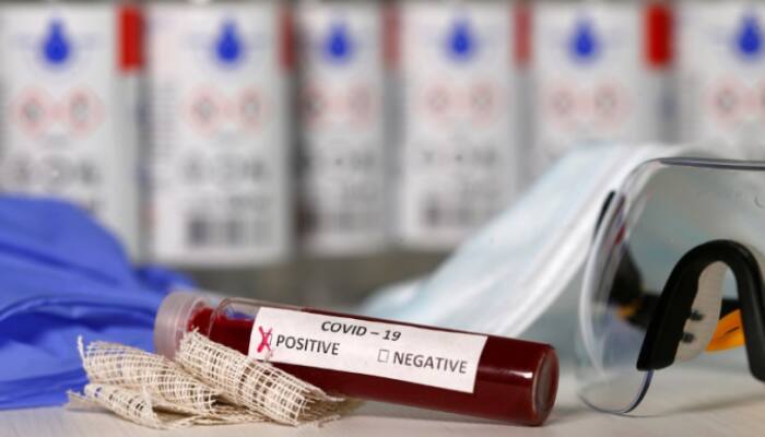 WHO releases 'life-saving' guidelines for health professionals treating coronavirus COVID-19 patients