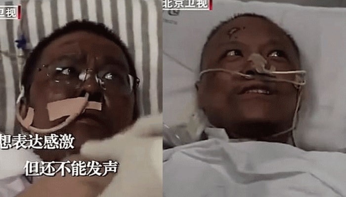 Critically ill with COVID-19, Chinese doctors wake up to find darkened skins, damaged liver