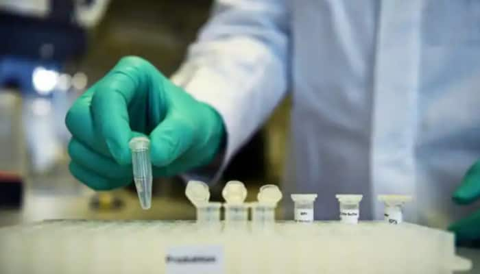 ICMR-NIV, Pune develop indigenous ELISA test kit for COVID-19 antibody detection 