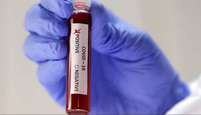 COVID-19 testing: Indigenous ELISA kits 92.37% sensitive and 97.9% specific, says ICMR