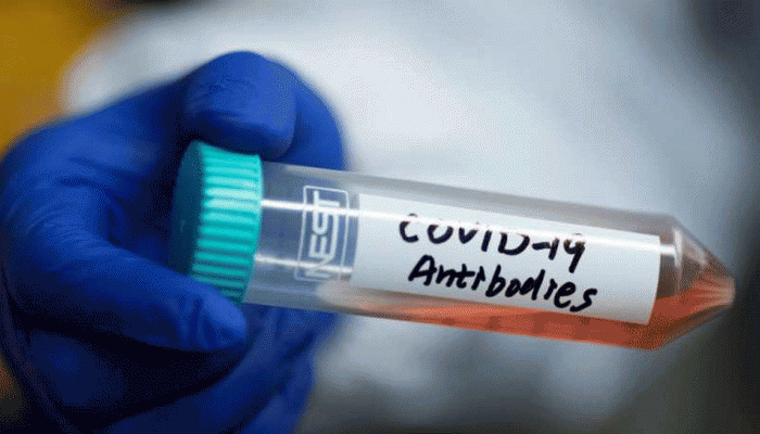 ICMR issues advisory on Antigen detection test for COVID-19