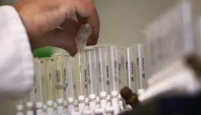 WADA to investigate International Weightlifting Federation doping allegations