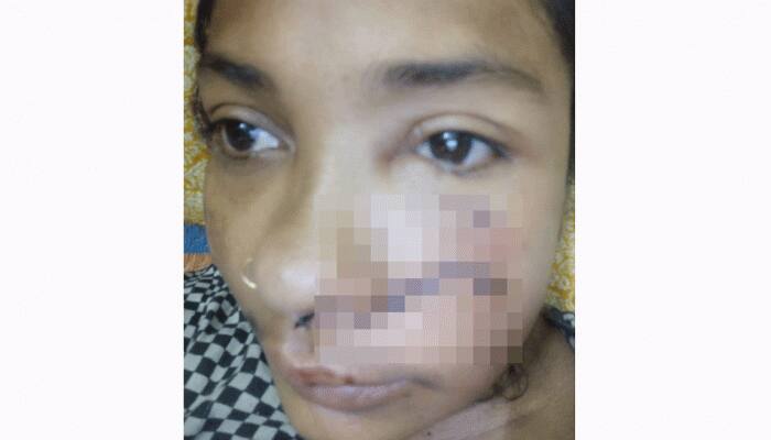 Delhi salon owner gets pet dog to attack, bite female staff for demanding salary