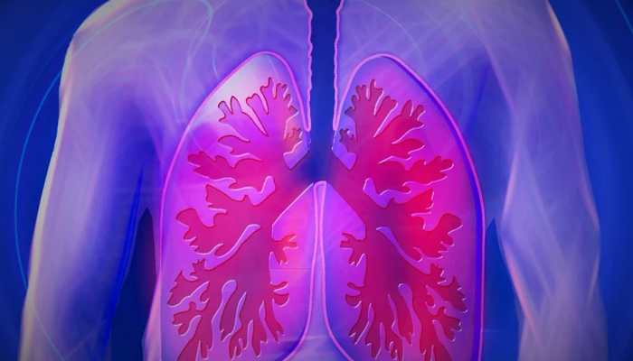 Severely damaged human lungs can be recovered by attaching them to pigs, claim researchers