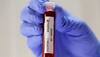 ICMR to launch study to evaluate efficacy of BCG vaccine against coronavirus COVID-19 in elderly