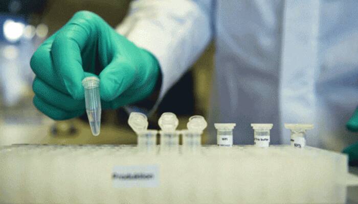 Odisha government issues COVID-19 testing guidelines, plans to opt RT-PCR method of testing
