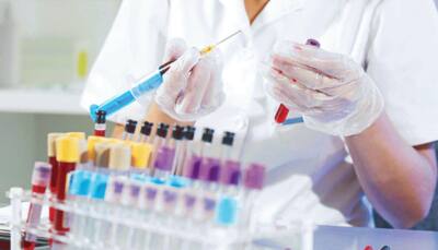 Petition filed in Delhi High Court against functioning of online pathology lab