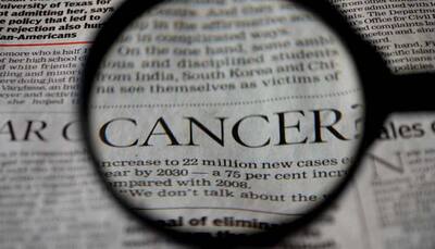 Cancer, its treatment may accelerate the aging process in young patients