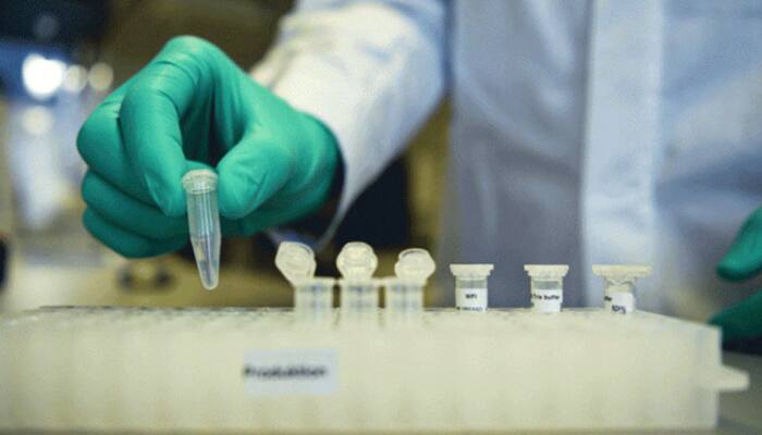 COVID-19 test price fixed at Rs 1600 in private laboratories of Uttar Pradesh 