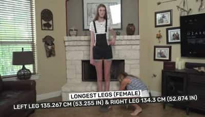 Meet the girl with longest legs in the world, here's what she wants to become in life