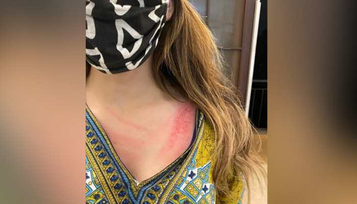 Kashmiri woman accuses landlady of calling her 'terrorist', DCW issues notice to Delhi Police