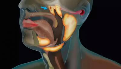 Researchers find new organ in throat that may help in treatment of cancer - Details here