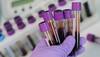 COVID-19 tests: CSIR-CCMB and Apollo Hospitals join hands for development of rapid, cost-effective kits 