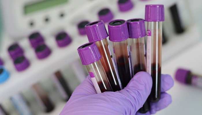 COVID-19 tests: CSIR-CCMB and Apollo Hospitals join hands for development of rapid, cost-effective kits 