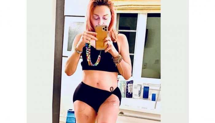 Madonna shows off her 'beautiful scar' on hip while flaunting her fit figure