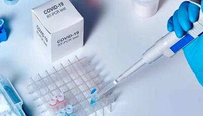 Uttarakhand reduces cost of COVID-19 RT-PCR, Rapid Antigen Tests, know how much it will cost now