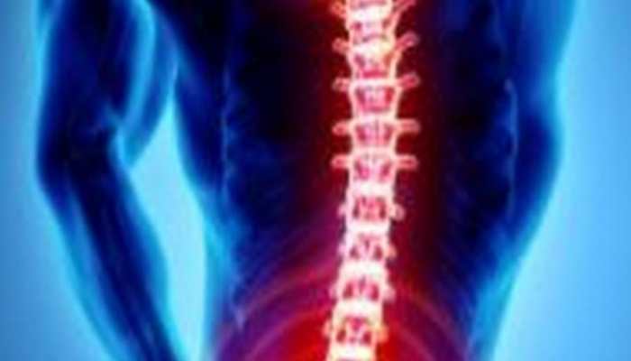 Here's how osteoporosis treatment got affected by COVID-19 pandemic