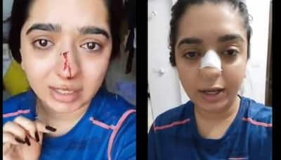 Zomato delivery executive punches Bengaluru woman after altercation for THIS reason