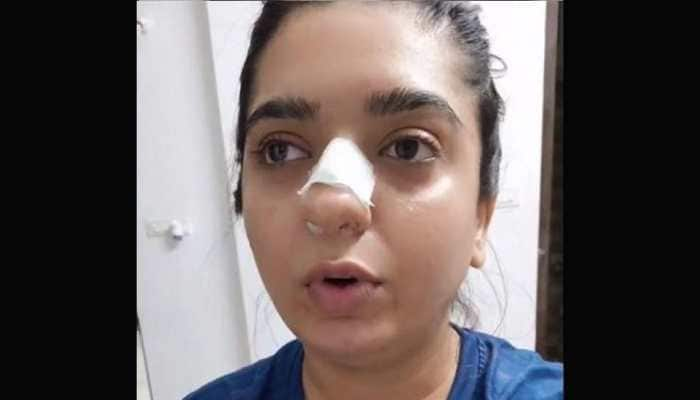 After woman accuses Zomato delivery boy of assault, latter alleges &#039;she hit her nose with her own ring&#039;