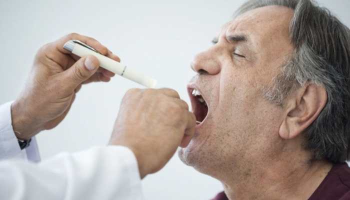 53-year-old Bengaluru man with cancer gets new tongue, find out how