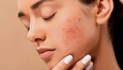 These skin problems can indicate a serious underlying health issues